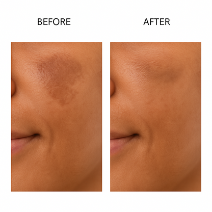 Dark Spot Corrector (with Niacinamide , Resveratrol, Vitamin C, Kojic Acid)
